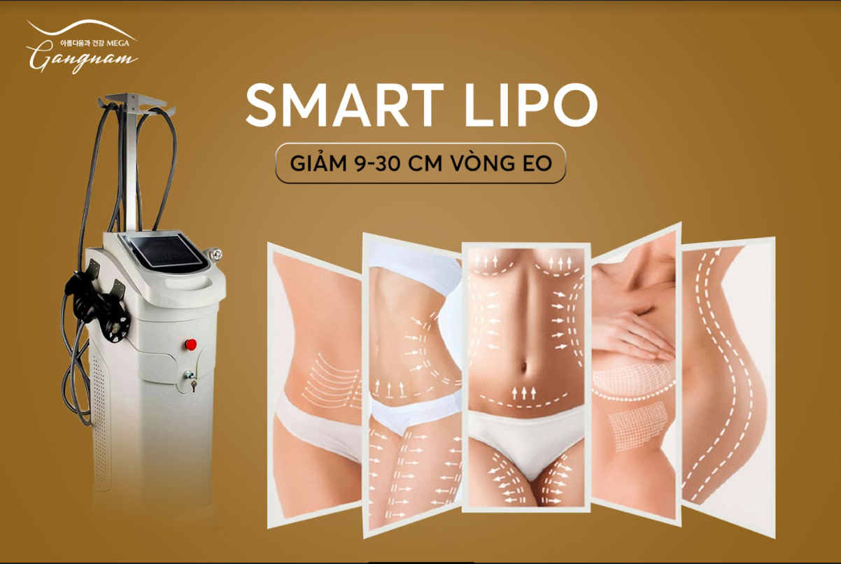 smart-lipo-giam-eo
