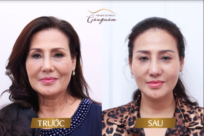 chi-my-linh-cang-chi