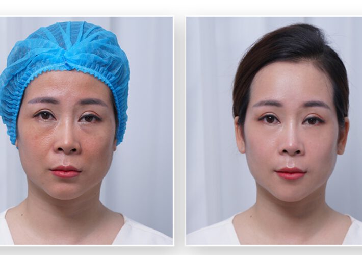 rediscovering-youthfulness-for-the-u40-breastfeeding-mother-03