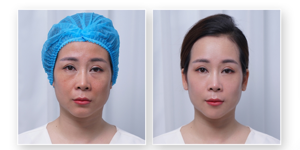 rediscovering-youthfulness-for-the-u40-breastfeeding-mother-03